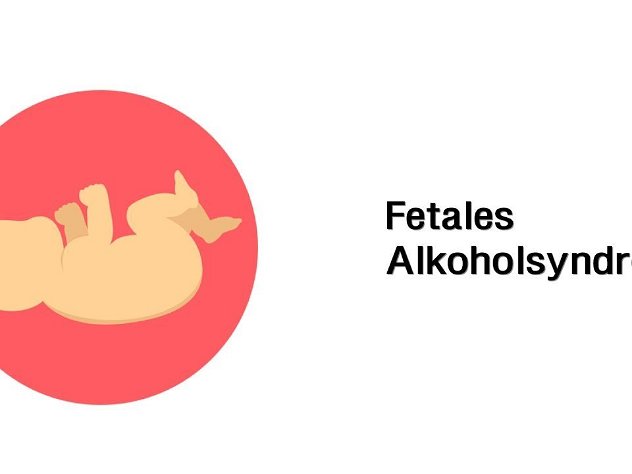 Fetales Alkoholsyndrom (FAS) - Kinderkrankheiten